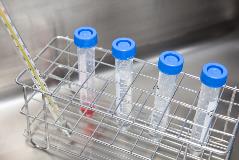 Prenatal paternity testing for court: your questions answered