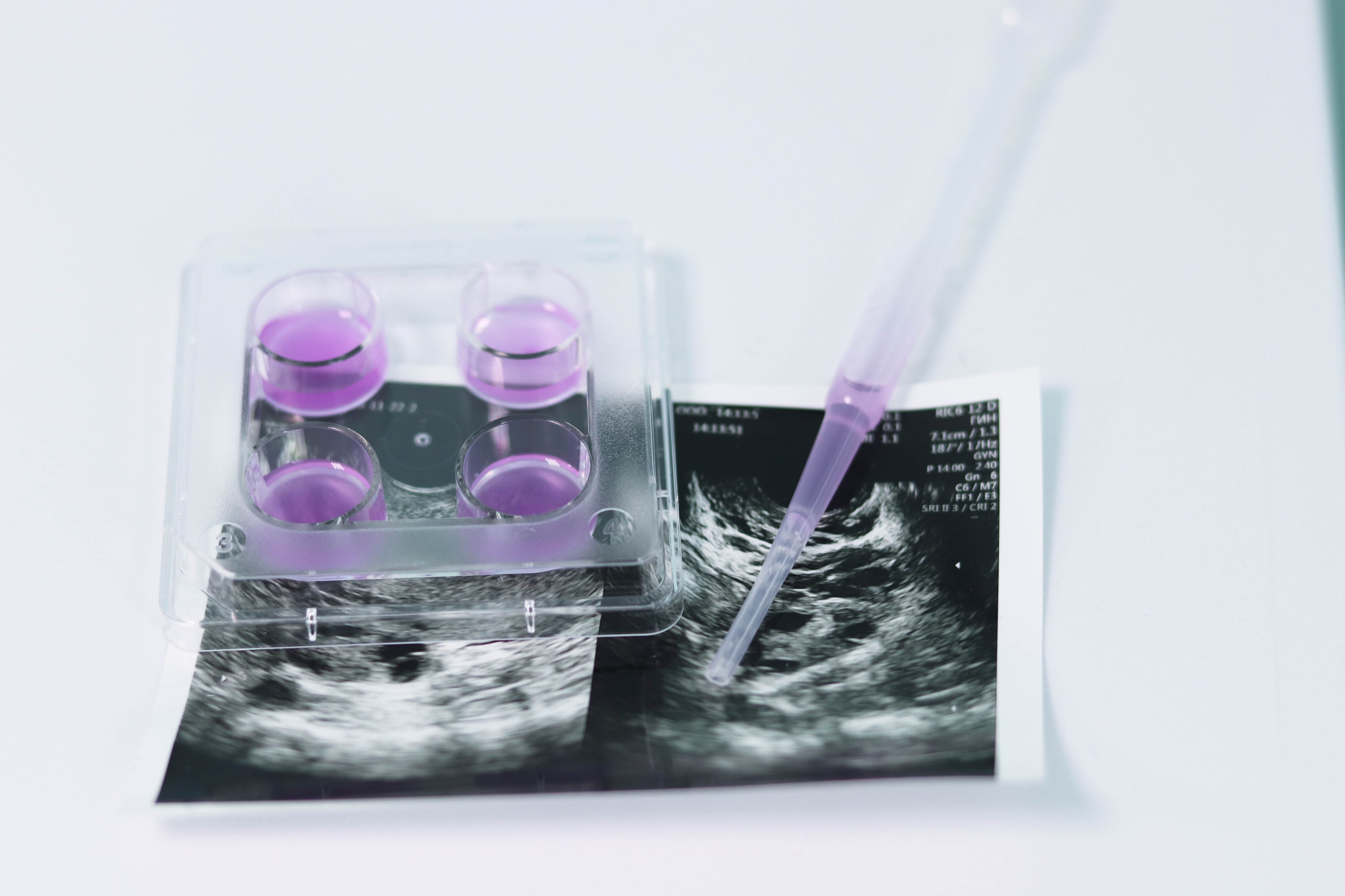 egg-freezing-time-limit-time-for-a-change